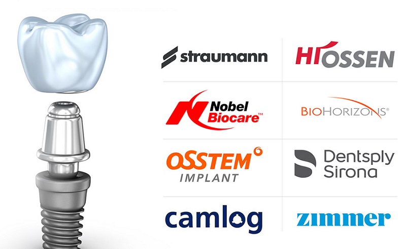 بهترین برند ایمپلنت دندان کدامند