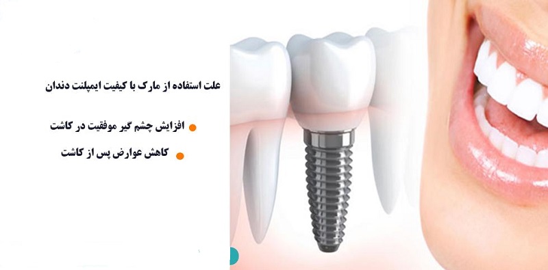 چه کشورهایی سازنده ایمپلنت هستند 