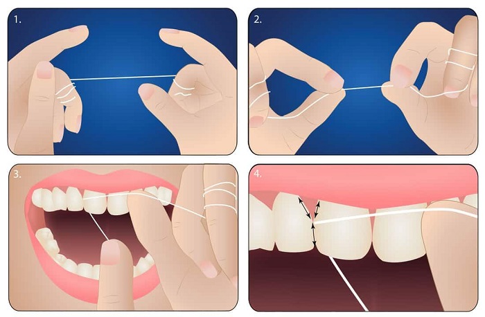 استفاده از نخ دندان چه اهمیتی دارد