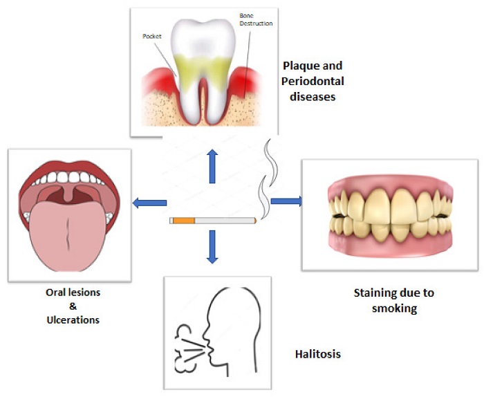 توصیه دندانپزشک برای اثرات سیگار روی دندان چیست