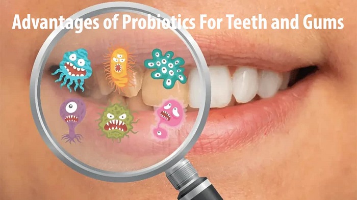 پروبیوتیک دندان چه مزایایی دارد