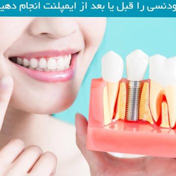 ارتودنسی و ایمپلنت دندان چگونه است