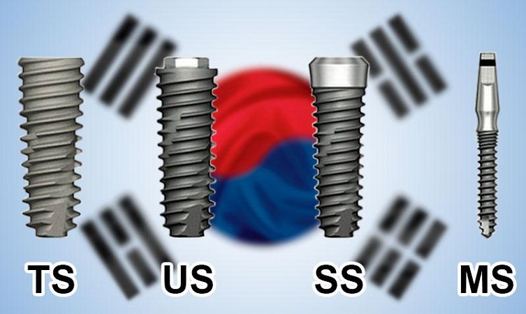 ایمپلنت کره ای چیست
