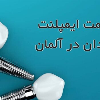 قیمت ایمپلنت آلمانی در تهران