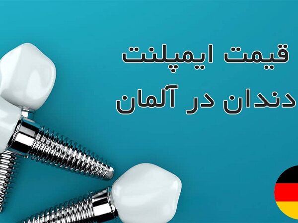 قیمت ایمپلنت آلمانی در تهران