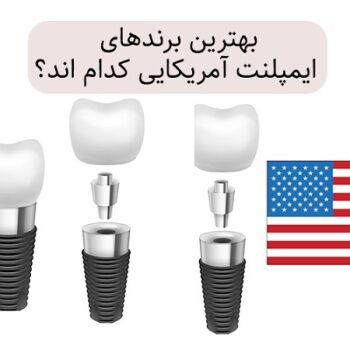 قیمت ایمپلنت آمریکایی با اقساط 12 ماهه